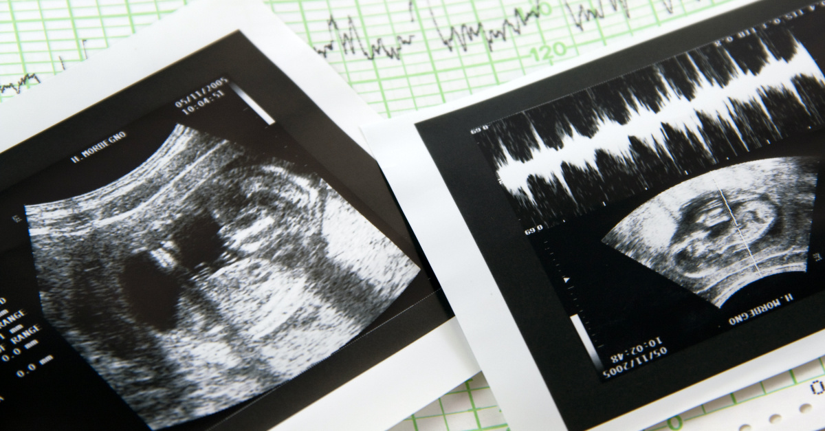 Colorado Passes Controversial Bill Declaring the Fetus ‘Does Not Have Independent’ Rights